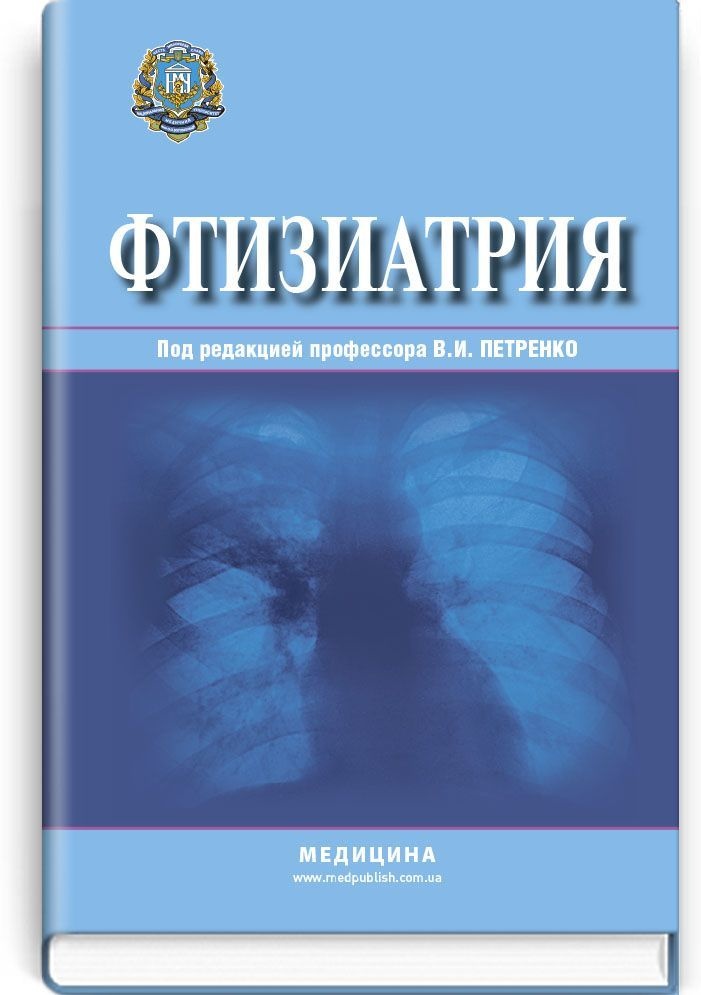 Фтизиатрия: учебник (ВУЗ ІV ур. а.)