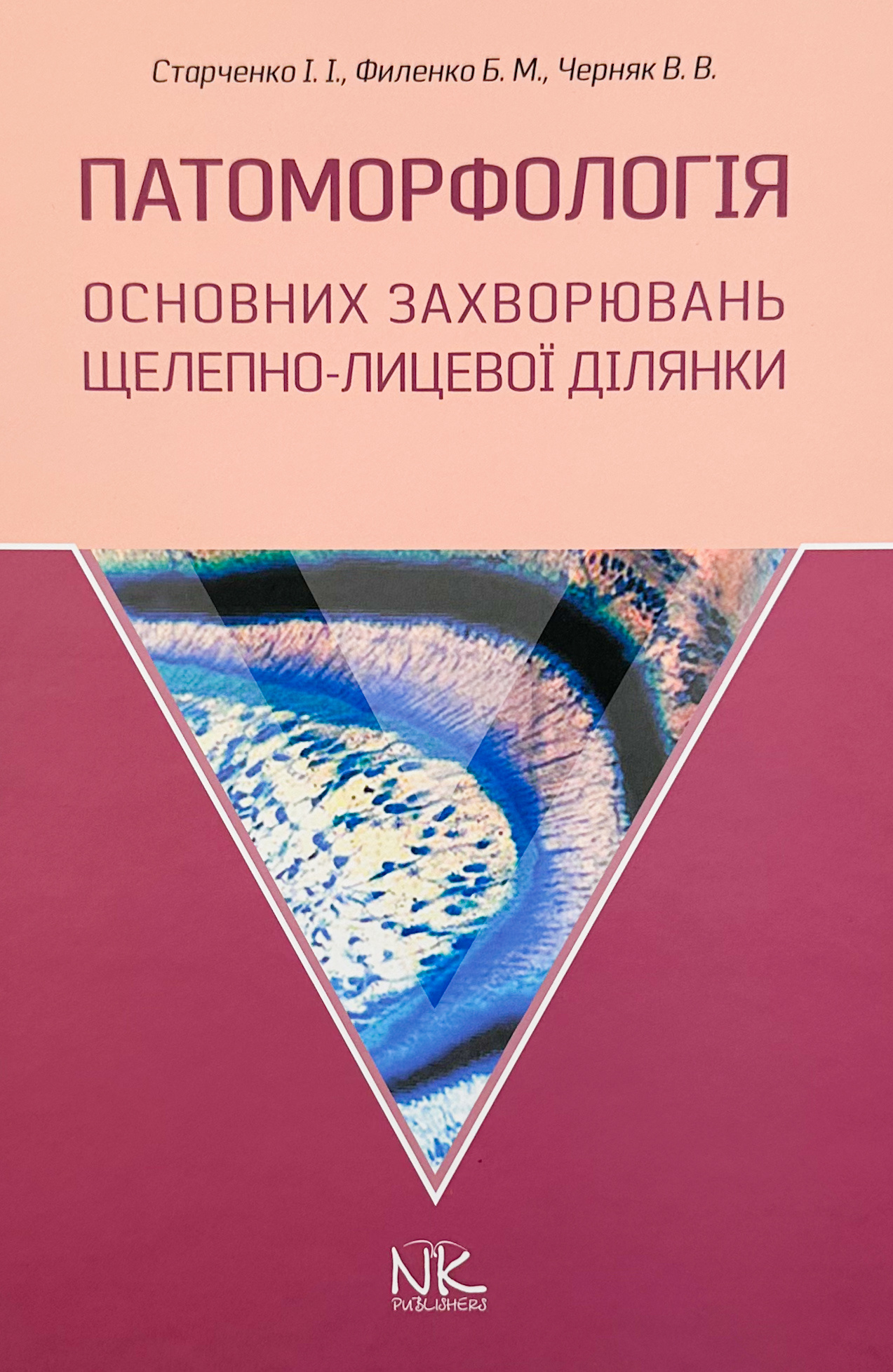 Патоморфологія основних захворювань щелепно-лицьової ділянки. Автор — Старченко І.І.. 