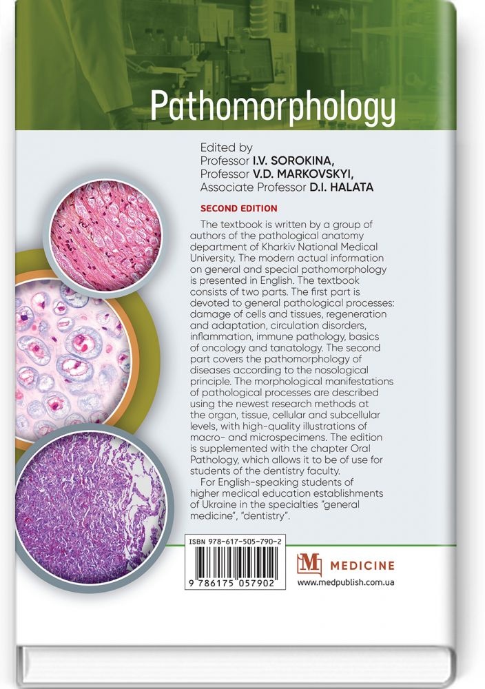 Pathomorphology: textbook. Автор — I.V. Sorokina, V.D. Markovskyi, D.I. Halata, A.F. Yakovtsova, M.S. Myroshnychenko, O.M. Pliten, S.M. Potapov, T.V. Bocharova, O.V. Kaluzhyna. 