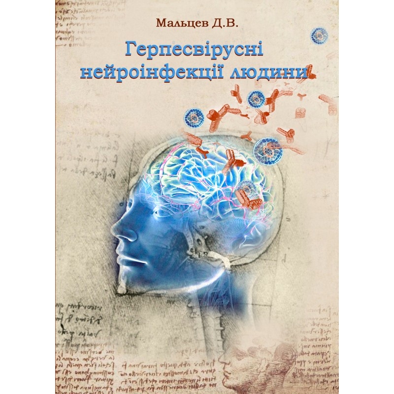Герпесвірусні нейроінфекції людини. Автор — Мальцев Д.В.. Обкладинка — 