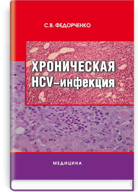 Хроническая HCV-инфекция: монография